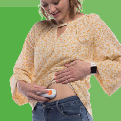 Dexcom paigaldamise nõustamise teenus